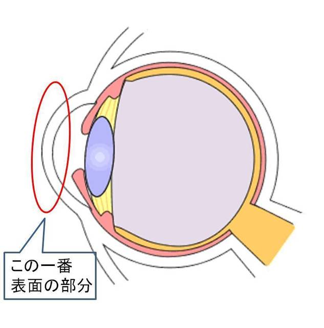 角膜紹介.jpg